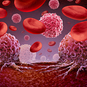 Blood Cancer